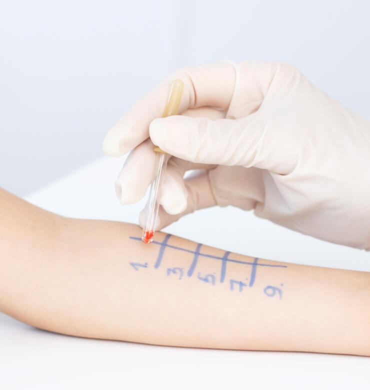 Allergy & Immunology